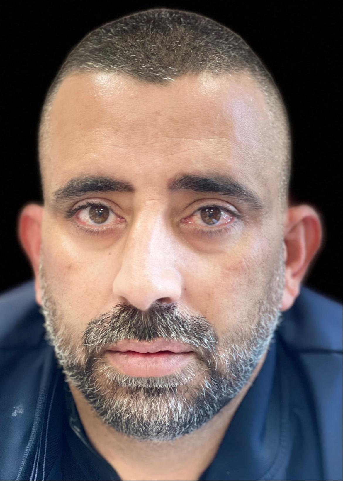 אמיר חמוד